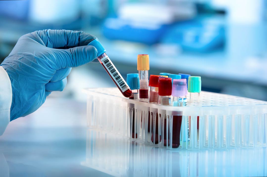Quecksilber im Blut