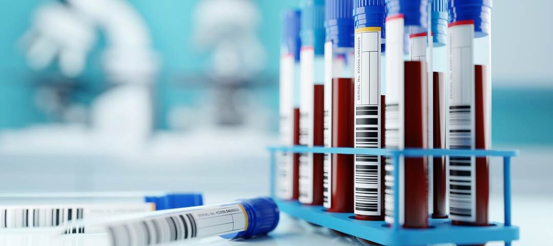 Stoffmonographie Blei Referenz- und Human-Biomonitoring-Werte